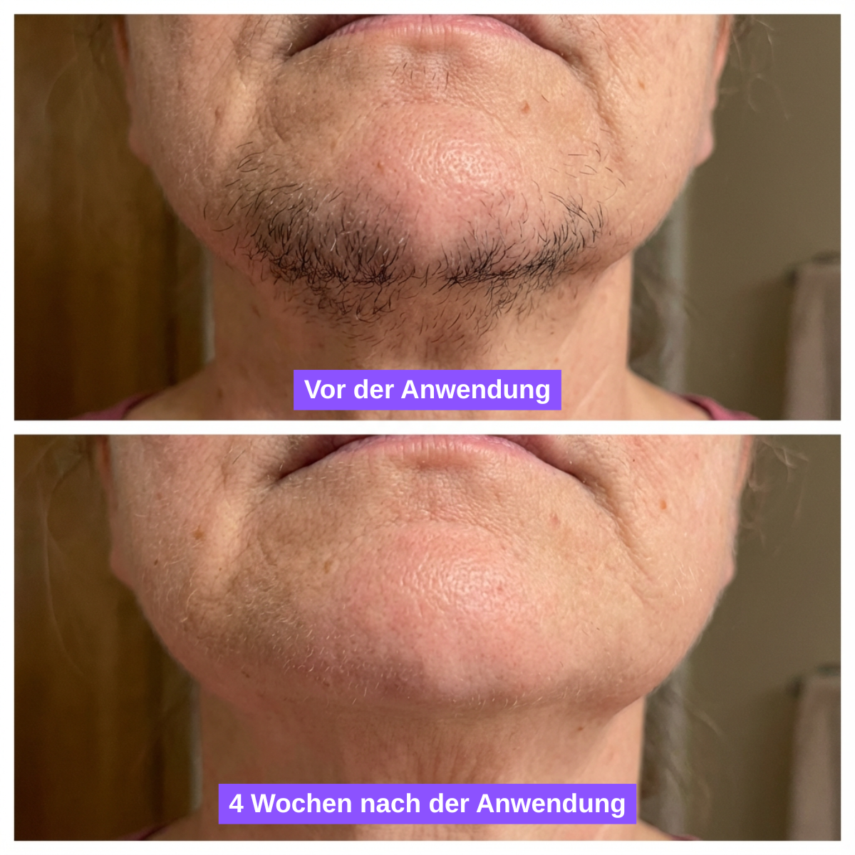 AfterGlow™ Haar-Stop Serum